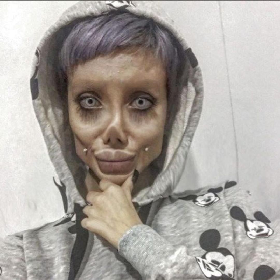 Angelina Jolie'ye benzemek i&ccedil;in bu hale gelmişti! İşte yeni g&ouml;r&uuml;nt&uuml;leri