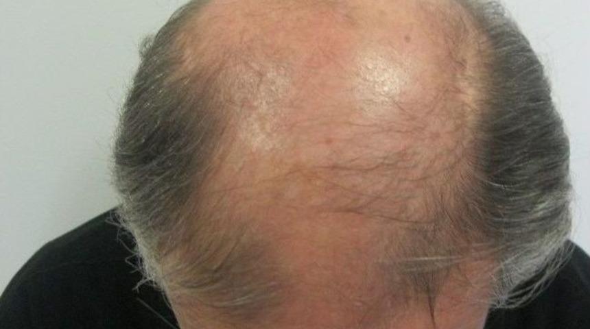 Sa&ccedil; Teli İle Rekor