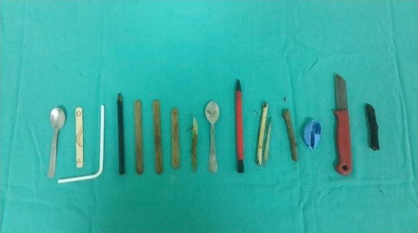 Midesinden 15 Adet Yabancı Cisim &Ccedil;ıkartıldı