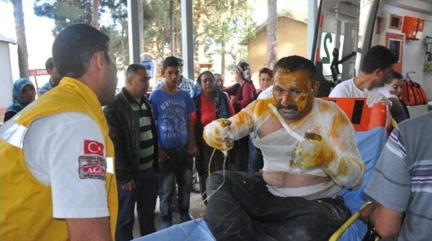 Boya Deposunda Yangın: 2 İş&ccedil;i Ağır Yaralı