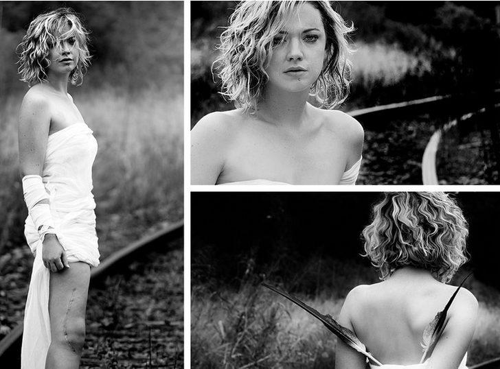 Bu yara izleri onlara hayatta ikinci bir şans verdi!