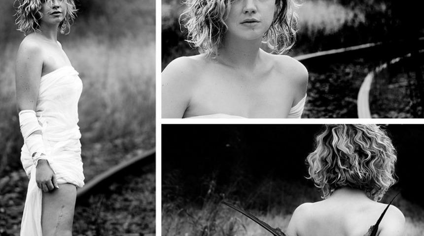 Bu yara izleri onlara hayatta ikinci bir şans verdi!