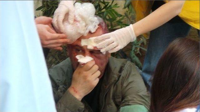 Plastik Sopalarla &Ouml;ld&uuml;resiye Dayak 1