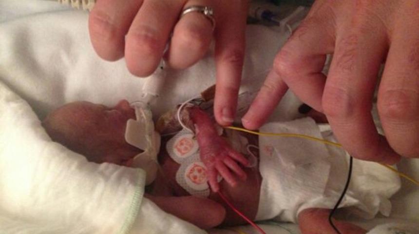 27 haftalıkken doğdu, hayata tutundu!