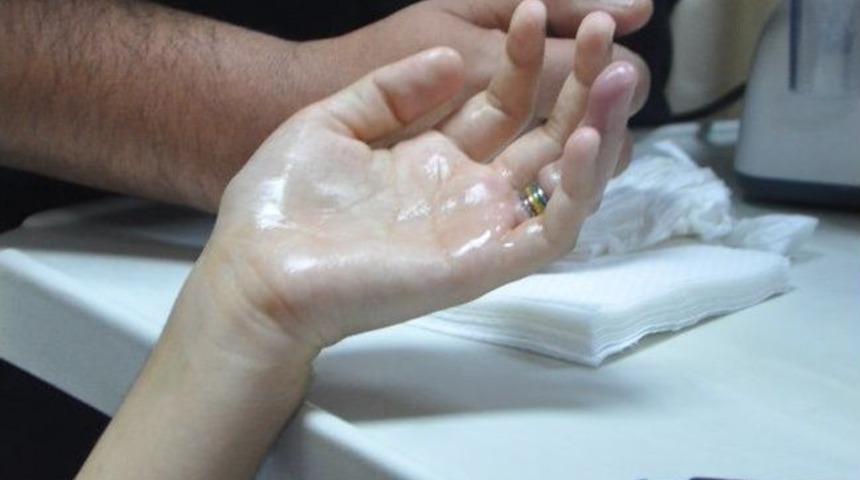 Aydın&rsquo;da Parmağındaki Y&uuml;z&uuml;ğ&uuml; &Ccedil;ıkartamayan Kadın İ&ccedil;in Hastane Ve İtfaiye Seferber Oldu