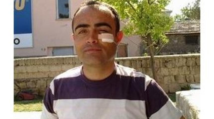 Şarj Olurken Patlayan Ak&uuml; Az Daha K&ouml;r Ediyordu