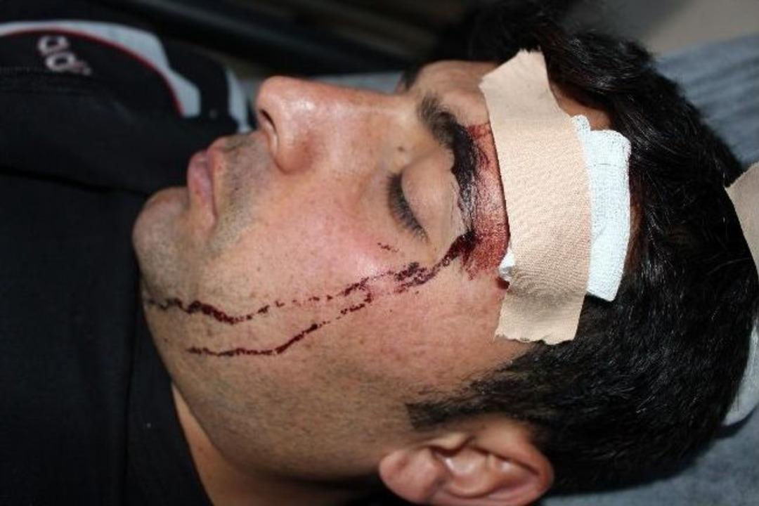 Ağrı'da 4 Polis Memurunun Yaralanması