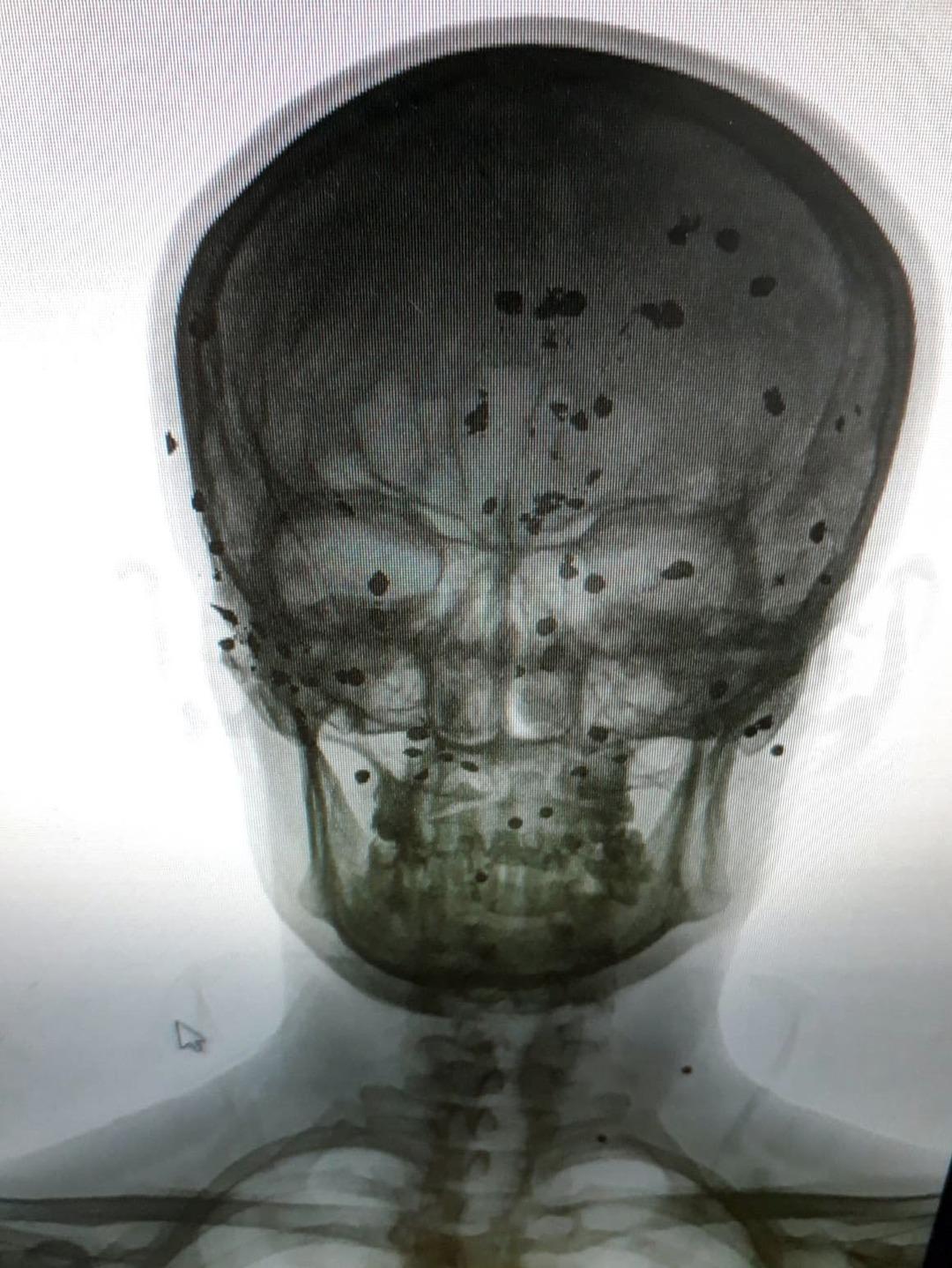 Tam 12 yıldır kafasındakilerle yaşıyor!