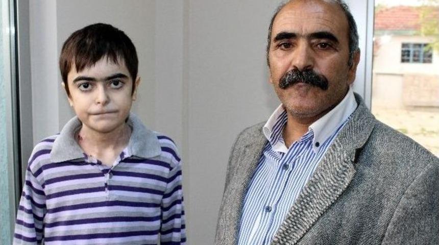 Deri Hastası &Ouml;mer, Bakan İslam&rsquo;dan Yardım İstedi