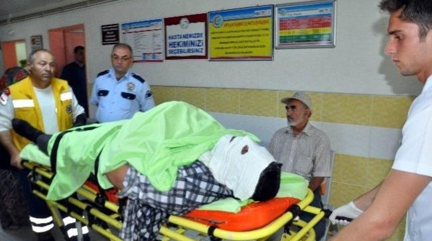 Duvara Çivi Çakarken Elektrik Panosu Patladı