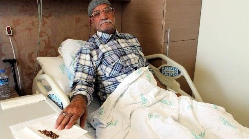 İdrar Torbasından 74 Tane Taş &Ccedil;ıktı