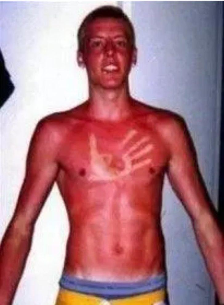 Yanmak istediler başları yandı! G4