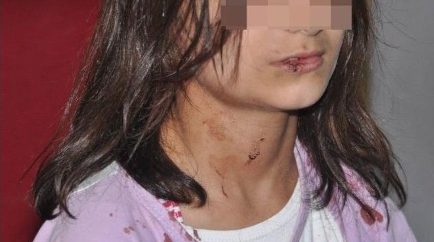 Şiddet G&ouml;ren &Ccedil;.t. Devlet Korumasına Alındı