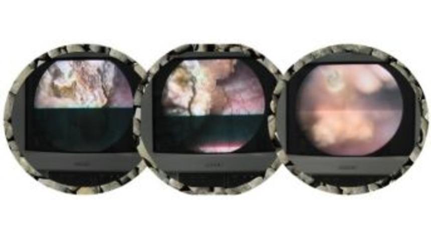 İskilip Atıf Hoca Devlet Hastanesi&rsquo;nde Bir İlk