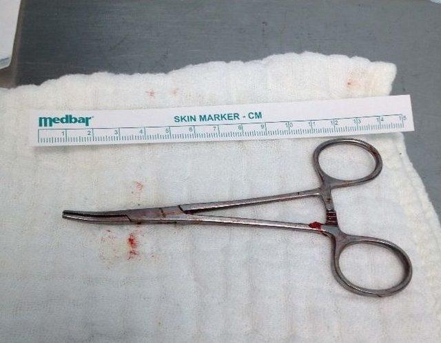 Iraklı Vatandaşın Karnından Makas Çıktı 1