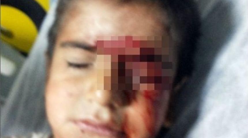 6 Yaşındaki Furkan'ın Nasıl Yaralandığı Araştırılıyor