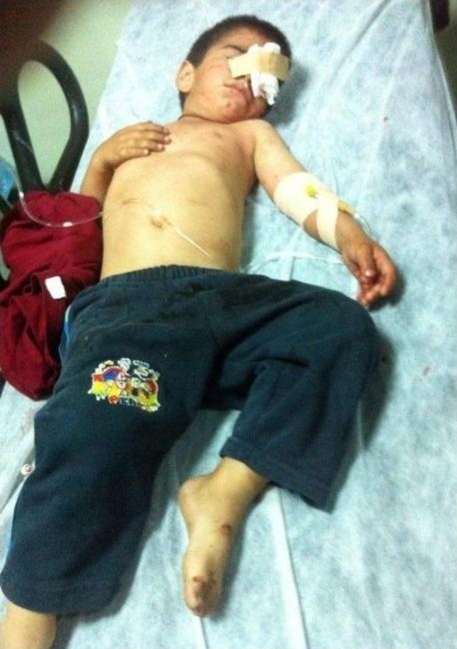 6 Yaşındaki Furkan ın Nasıl Yaralandığı Araştırılıyor 1