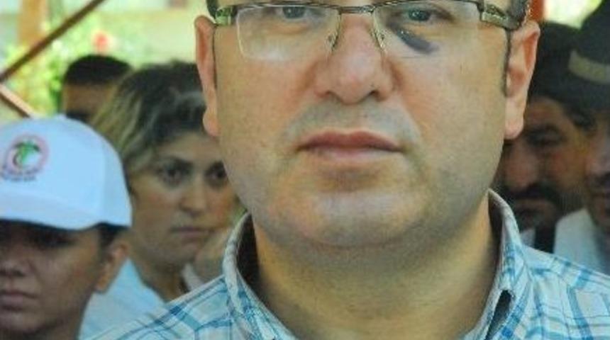 Rapor Vermeyen Doktoru Darp Etti