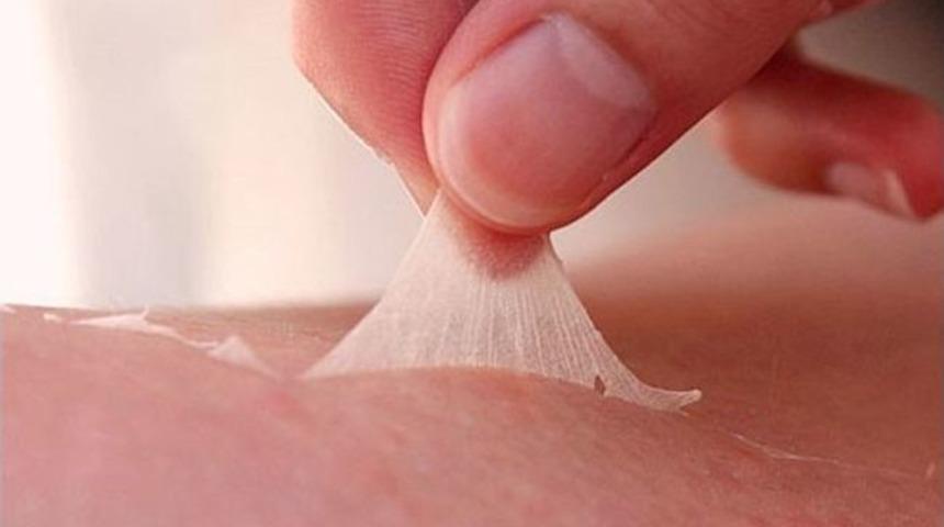 Yaz Aylarında Artan Cilt Rahatsızlıklarına Dikkat