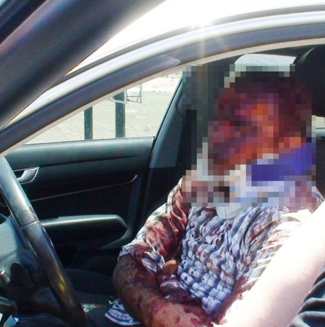 Birbirlerinin Kulaklarını Bı&ccedil;akla Kopardılar