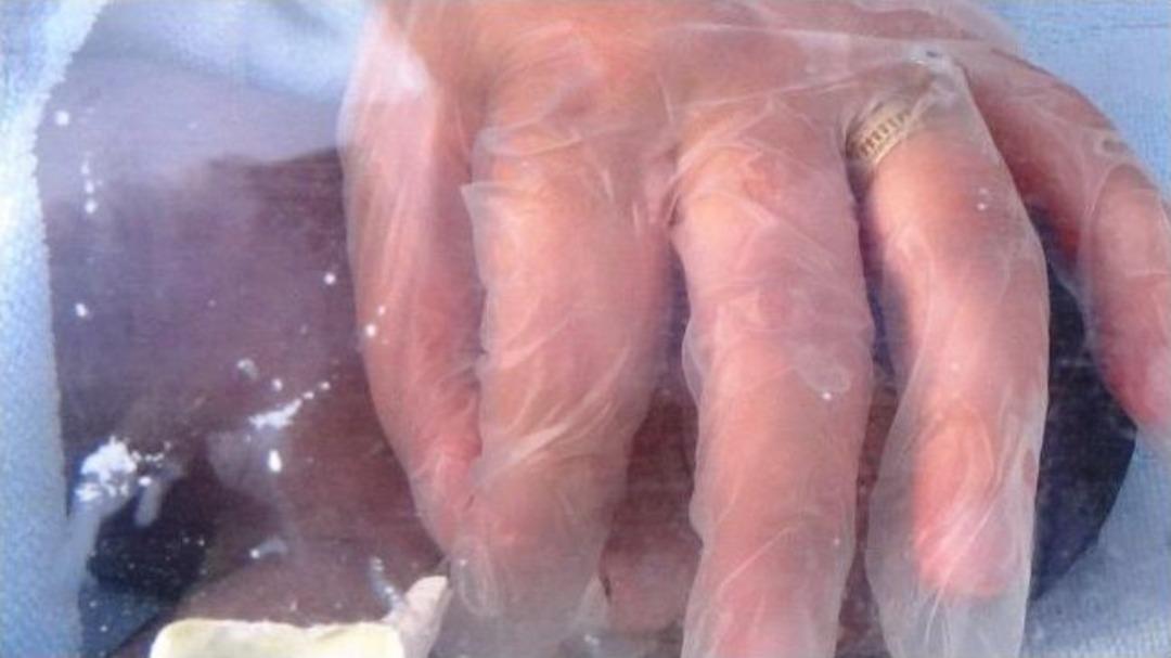 Erken D&uuml;nyaya Gelen Minik Bebeğin Sevk Anında Kalbi Durdu