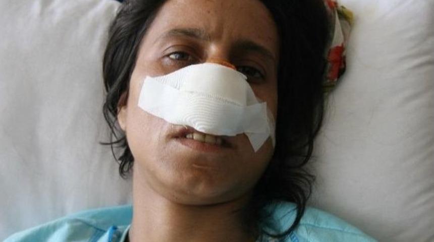 (&ouml;zel Haber) Kadına Şiddette Son Nokta