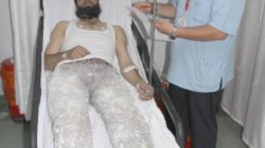 Boya Yaparken Elektrik Akımına Kapıldı