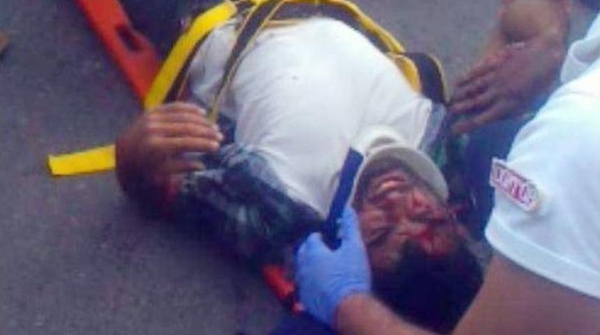 Otomobil İle Motosiklet &Ccedil;arpıştı: 2 Yaralı