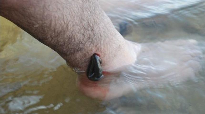 Hastalara S&uuml;l&uuml;kl&uuml; Tedavi