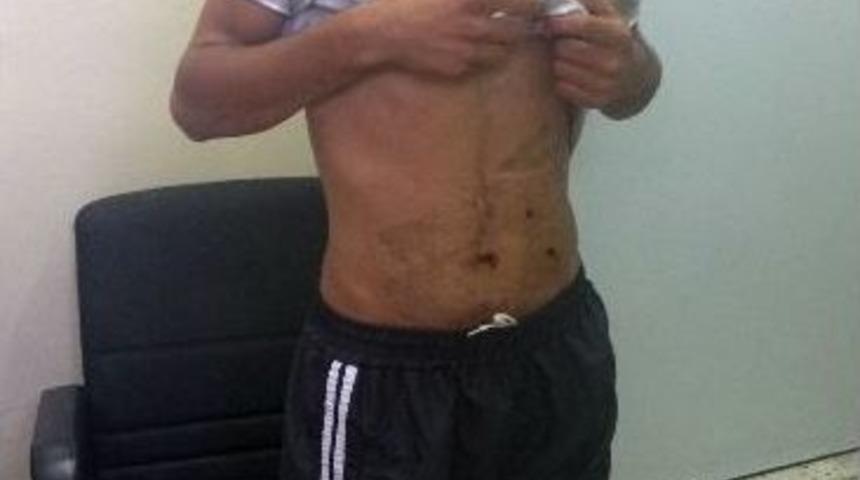 Silvan'da Kapalı Y&ouml;ntemle B&ouml;brek Alma Ameliyatı Yapıldı