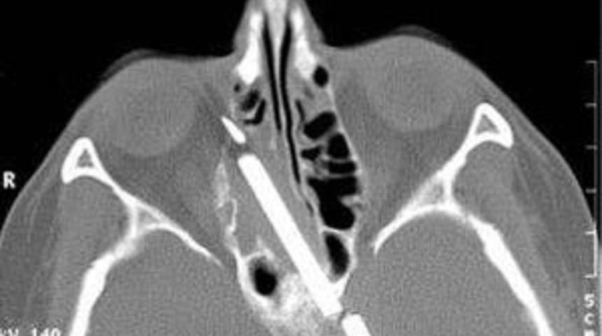 MİDESİNDEN VANA &Ccedil;IKTI