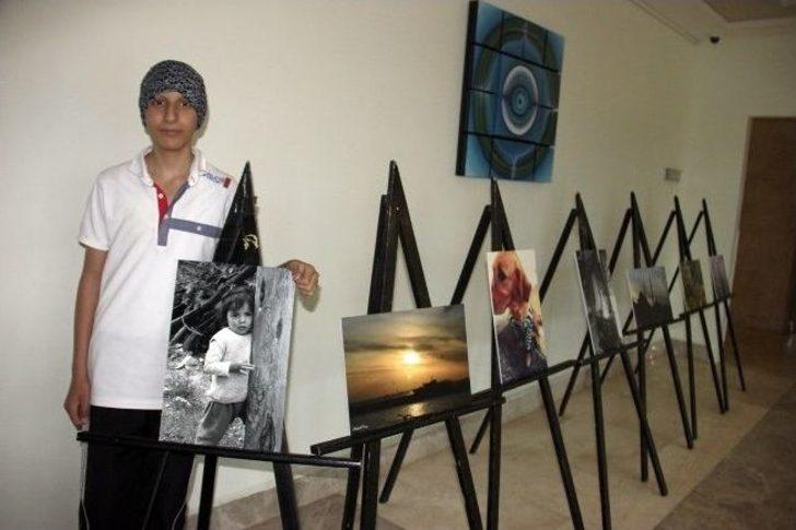 (özel Haber) Kemoterapi İçin Gittiği Hastanede Sergisiyle Karşılaştı G1