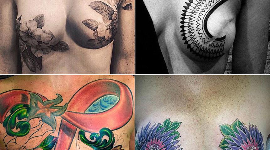 Kanserin bıraktığı izi d&ouml;vmeyle g&uuml;zelleştirdiler!