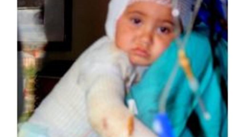 Tandıra D&uuml;şen &Ccedil;ocuk Feci Şekilde Yandı