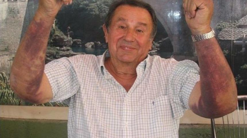 (&ouml;zel Haber) Bosna Sancak Derneği Eski Başkanına Sopalı Saldırı