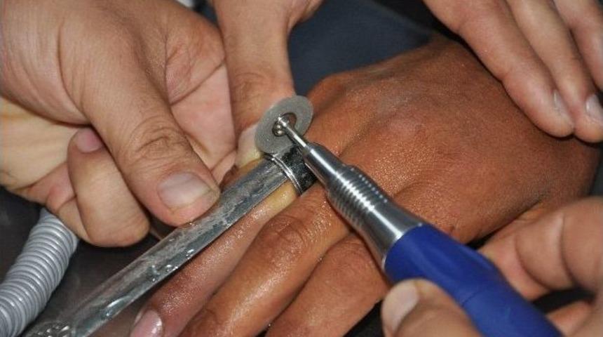 2 Yıldır Parmağından &Ccedil;ıkarmadığı Y&uuml;z&uuml;kler Kangren Ediyordu