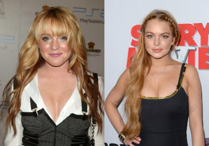 Estetik yaptıran &uuml;nl&uuml;ler