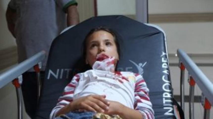 Y&uuml;ksekten D&uuml;şen &Ccedil;ocuk Yaralandı