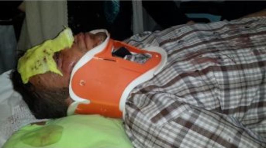 Babasının Cenazesini Almaya Giderken Kazada Yaralandı