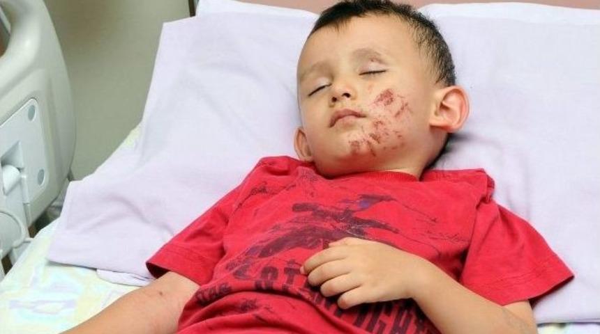 &Uuml;&ccedil;&uuml;nc&uuml; Kattan D&uuml;şt&uuml;, Burnu Bile Kanamadı