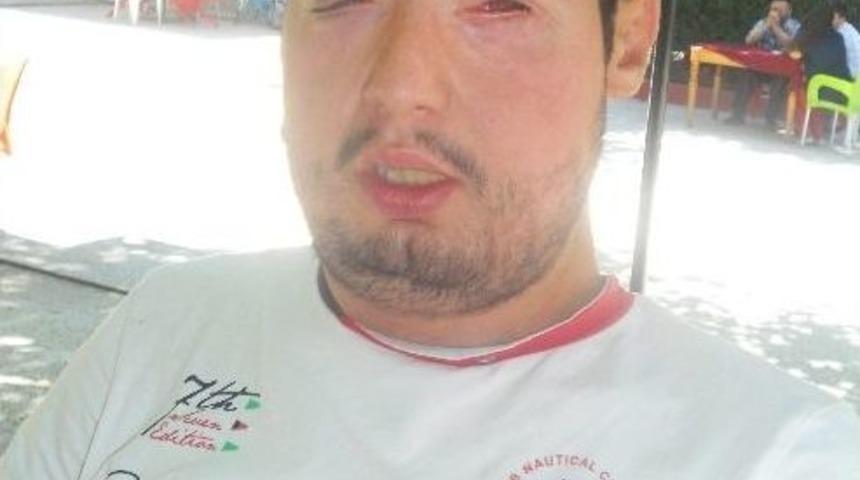 T&uuml;rkiye'nin 4. Y&uuml;z Nakli Olan Turan &Ccedil;olak: