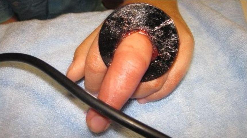 İstanbul İtfaiyesi&rsquo;nden Parmak Kurtarma Operasyonu