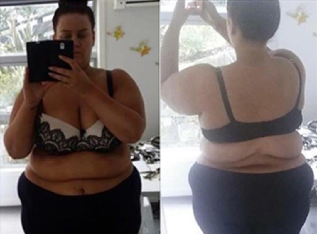 M&uuml;thiş değişim! Son halini g&ouml;ren tanıyamıyor