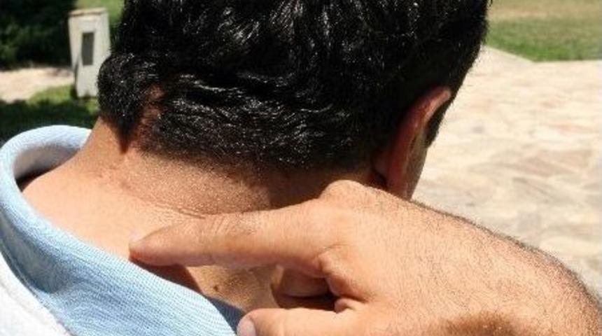 (&ouml;zel Haber) Kafasında Unutulan İğneler Hayatını Kararttı