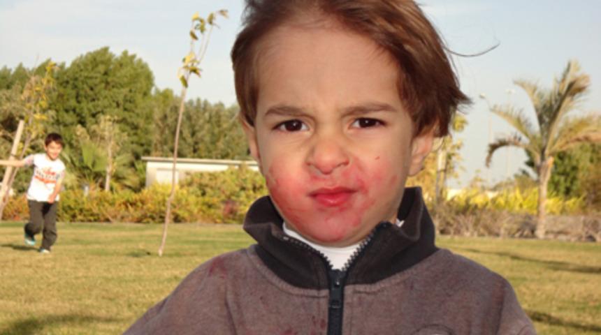 Meyve lekeleri sorun olmasın!