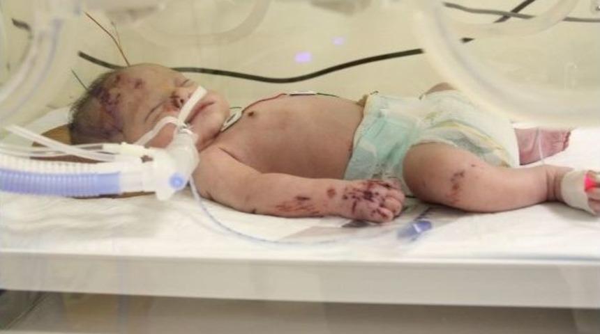 Apartman Boşluğunda Bulunan Bebek