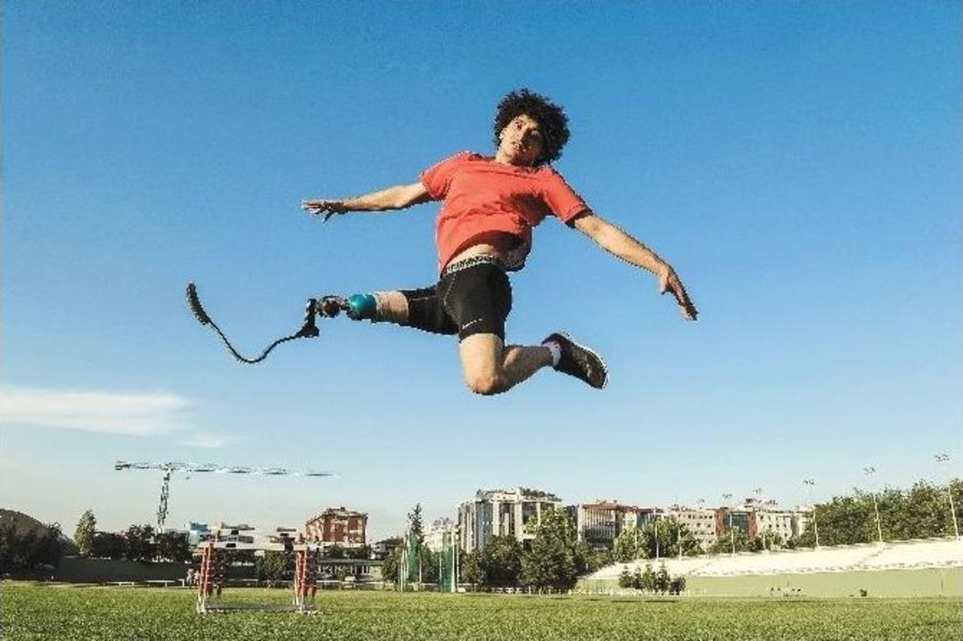 Tek Ayağını Kaybetmesine Rağmen Hayallerinin Peşinden Koştu