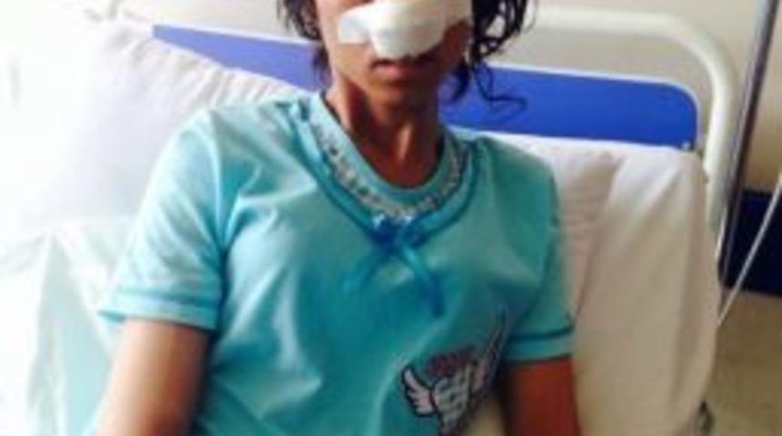 Kendisini Dağa Ka&ccedil;ırıp Burnunu Kesen Kocasını Affetti