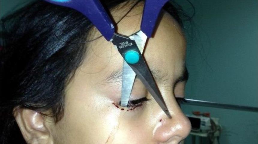 Makas Y&uuml;z&uuml;ne Saplandı