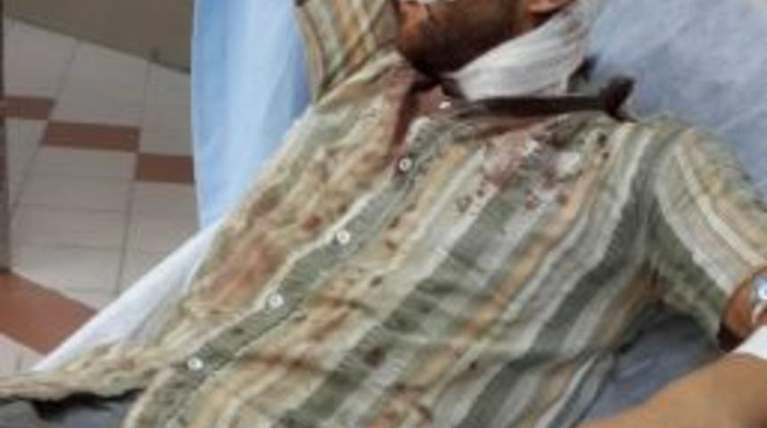 Patpat Devrildi: 4 Yaralı